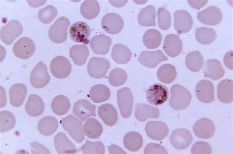 Malaria Plasmodium Species