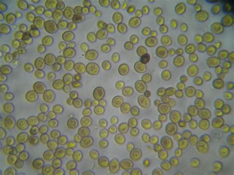 CIENCIAS NATURALES 1 OJA OBSERVACIÓN DE LEVADURAS