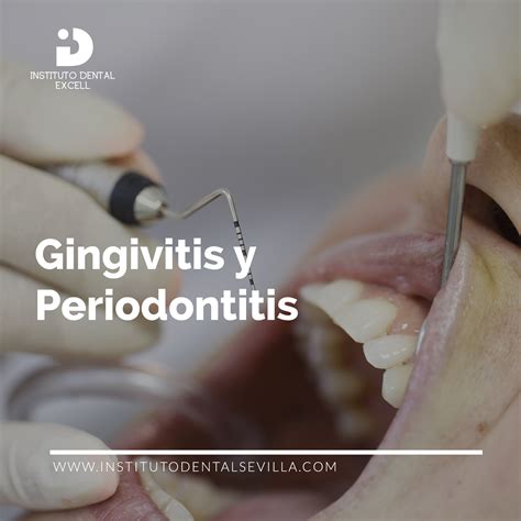 QUÉ ES Y CUALES SON LAS CAUSAS DE UNA GINGIVITIS O PERIODONTITIS