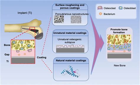 K Pt R Csupasz Mikrokomputer Ha Coated Implants Ki Divat Kitetts G