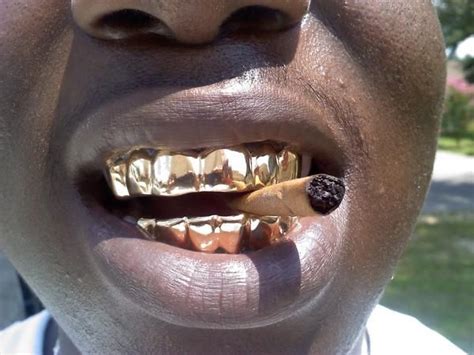 Best Gold Teeth In Florida - Dwain Austin Hochzeitstorte