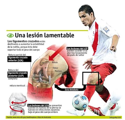 Dolor De Rodillas Después De Jugar Fútbol Causas Y Prevención