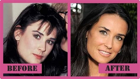 Demi Moore Plastic Surgery - Rumor Or An Unrevealed Truth!