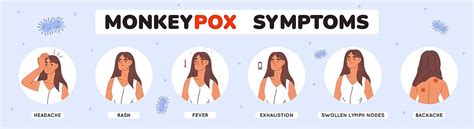 Monkeypox Virus Symptoms Detailed Infographic Design Monkeypox Symptoms ...