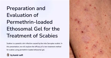 Preparation And Evaluation Of Permethrin Loaded Ethosomal Gel For The