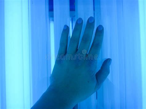 Phototherapy Dermatosis. Treatment of Skin Diseases - Psoriasis, Ekzemy ...