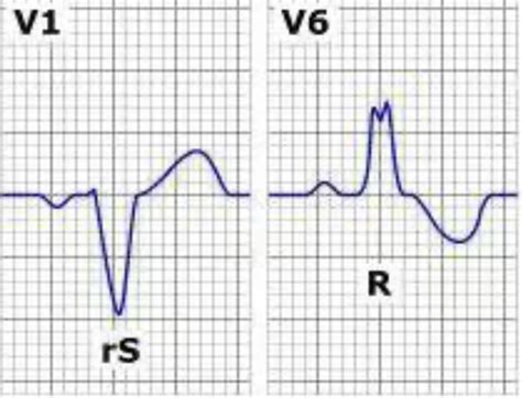 Nremt Prep Cardiologyresuscitation Flashcards Quizlet