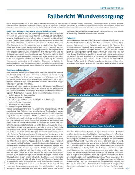 Ulcus Cruris Venosum Apotheker Dr Christian Franken