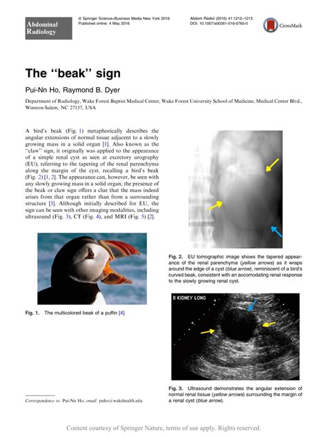 The “beak” sign | Request PDF