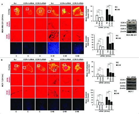 Macrophage Assisted ECM Degradation And Invasion By Cancer Cells Is