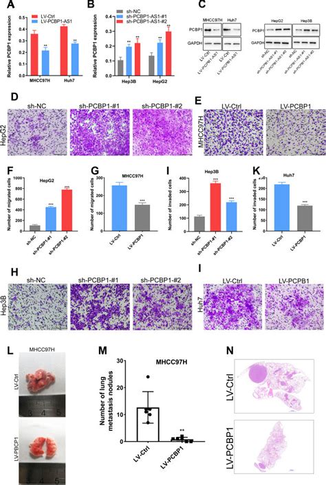 Pcbp Inhibits Hcc Cell Invasion And Metastasis In Vitro And In Vivo