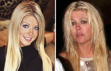 Horrible: 18 Shocking Photos Of Famous Celebrities Before And After Drugs Addiction - GhPage