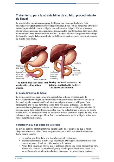 PDF - Tratamiento para la atresia biliar de su hijo: procedimiento de