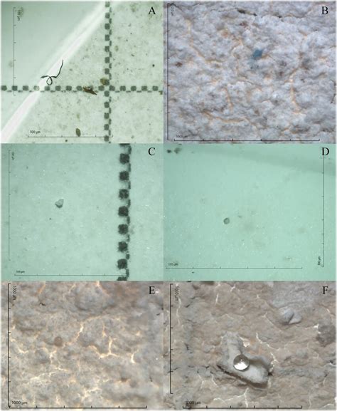 Different Types Of Microplastics In Mangrove Crab Fiber A Film B