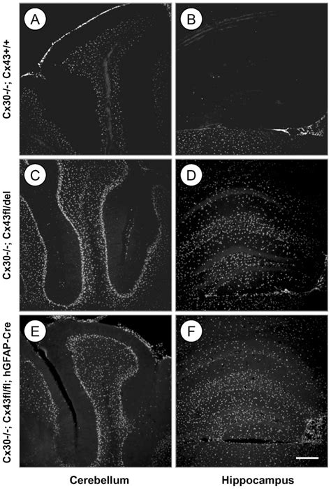 A B Antibody Staining Of Cx30 Mice Shows The Distribution Of β Gal