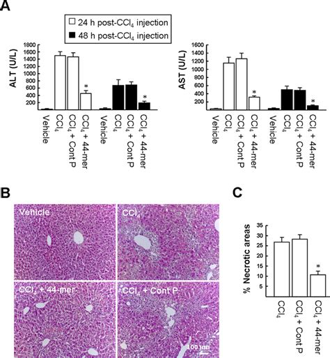 The 44 Mer Protects The Liver Against Ccl 4 Induced Acute Liver