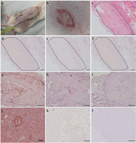 Minimal Immune Cell Responses To Decellularized Human Pancreatic Matrix