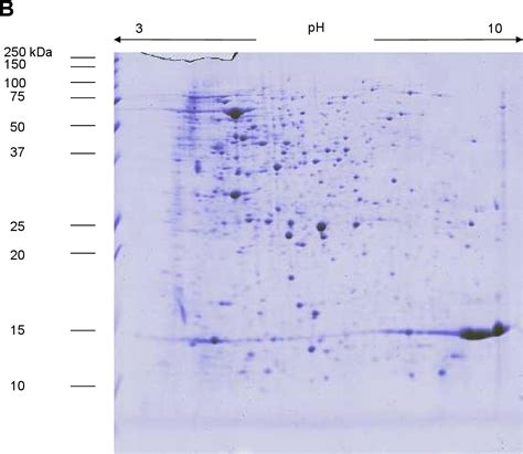 Figure From Comparative Proteomic Analysis Of Protein Patterns Of