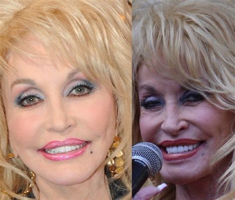 7 best Dolly Parton Plastic Surgery images on Pinterest | Dolly parton ...