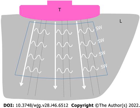 Schematic Illustration Of Two Dimensional Shear Wave Elastography