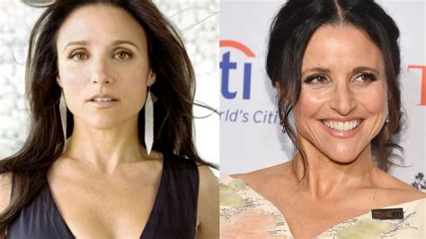 Julia Louis Dreyfus Plastic Surgery Elaine Benes From Seinfeld Looks