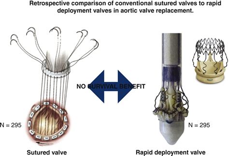 Rapid The American Association For Thoracic Surgery AATS