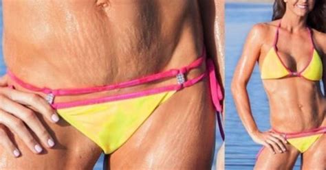 Trucs Et Astuces Pour Porter Un Bikini Sans Faire Para Tre Ses Vergetures