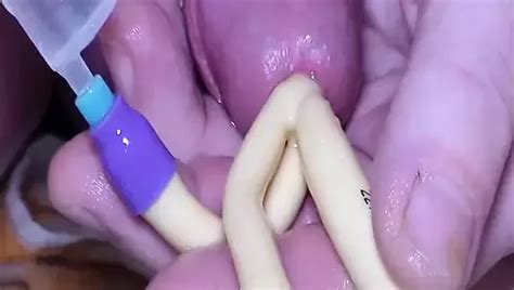 Blasenkatheter Legen Free Gay Porn Video 29 XHamster
