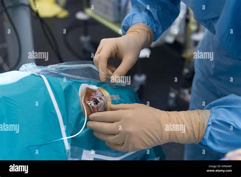 RETINAL DETACHMENT, SURGERY Stock Photo - Alamy