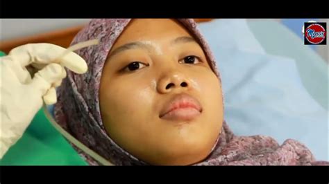 Pemasangan Nasogastric Tube Ngt Youtube