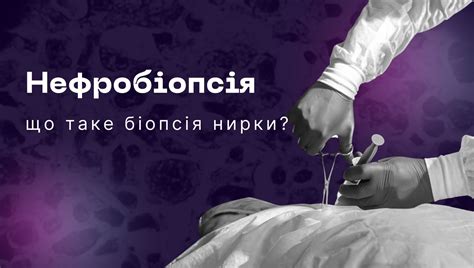 НЕФРОБІОПСІЯ: Що таке біопсія нирки? | Нефроцентр