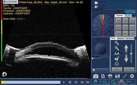 Sight Ophthalmic Ultrasound Platform