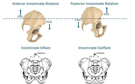 Articolazione Sacro Iliaca Scopriamo Di Più Formative Zone