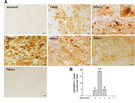 Figure 6 From Correlation Between Fibrillin 1 Degradation And MRNA