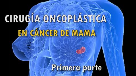 CIRUGÍA PLÁSTICA y CÁNCER DE MAMA Reconstrucción Mamaria inmediata