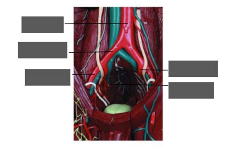 Branches Of Common Iliac Artery Diagram Quizlet