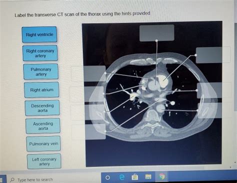 Solved Label The Transverse Ct Scan Of The Thorax Using The