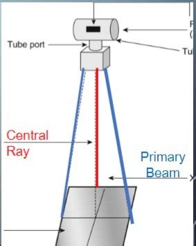 Radiology Components Of Xray Machine Flashcards Quizlet