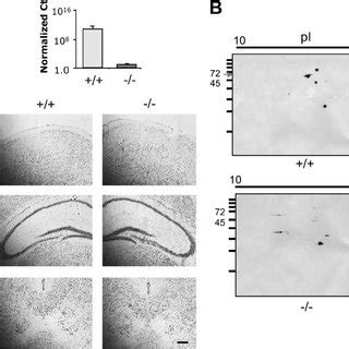 Brain Region Specific Alterations In 5 HT1A MRNA Expression In Deaf 1