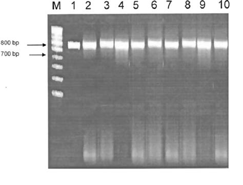 Results of amplified PCR product in between 700 and 800 bp as revealed ... 