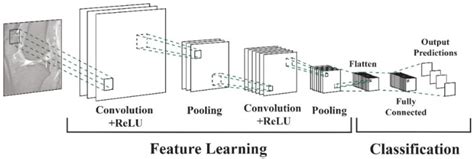 A Comprehensive Evaluation Of Deep Learning Models On Knee MRIs For The