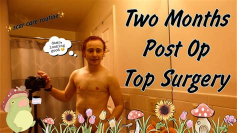 Two Months Post Op Top Surgery And Scar Care Routine Youtube