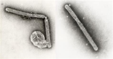 Human Influenza Virus Microscope