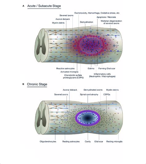 Pathophysiology Of Spinal Cord Injury Sci A The Diagram Shows