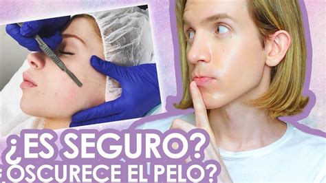 Dermaplaning La opinión de los dermatólogos que debes conocer