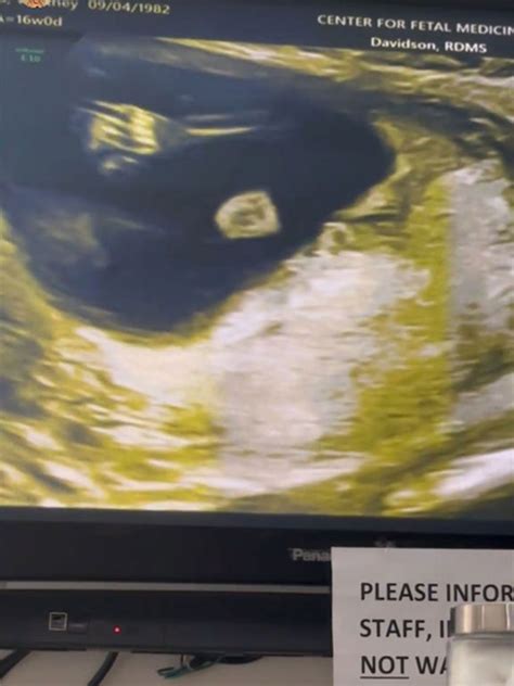 Pregnant Whitney Cummings Reveals the Sex of Her Baby