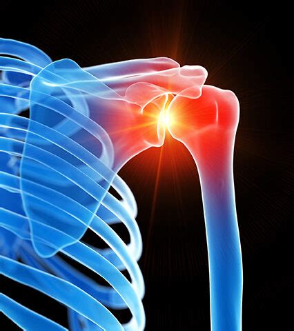 Rotator Cuff Surgery - Hy-Tape International, Inc.