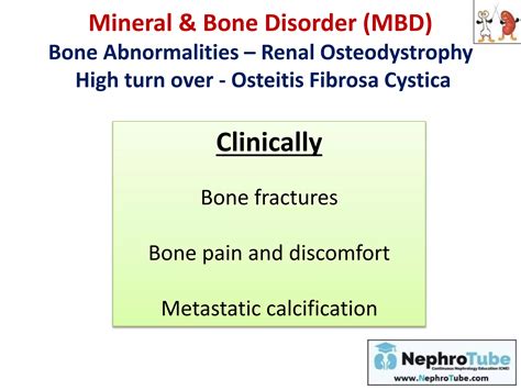 Ckd Mineral Bone Disorder Ckd Mbd Dr Gawad Ppt