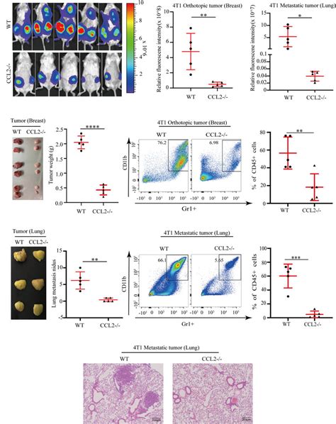 Ccl Promotes The Growth And Metastasis Of Breast Cancer By