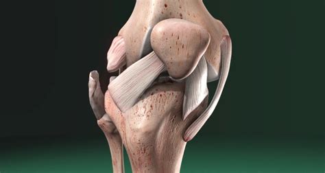 LCL Lateral Collateral Ligament Injury